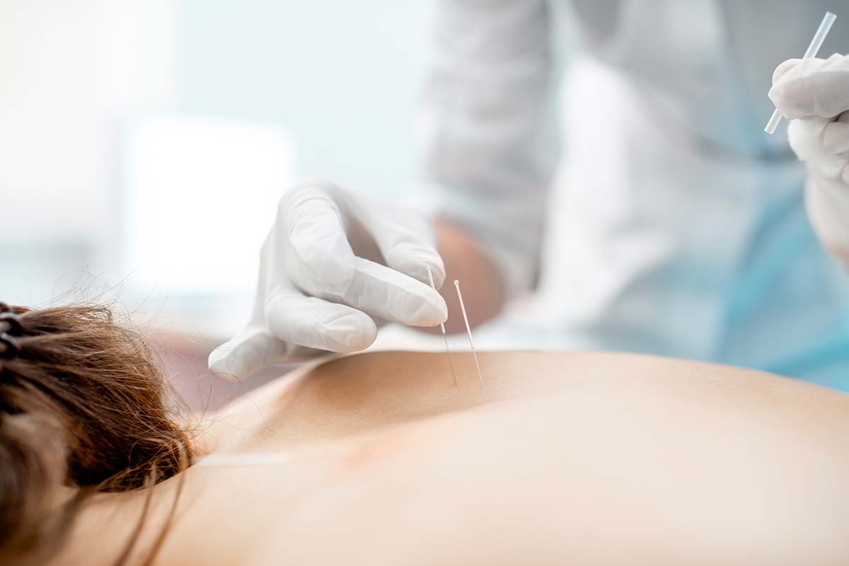 acupuncture et fertilité